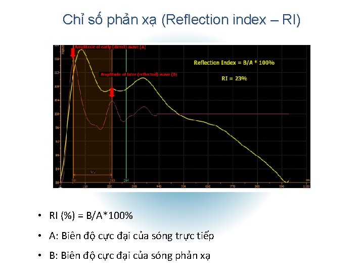 Chỉ số phản xạ (Reflection index – RI) • RI (%) = B/A*100% •