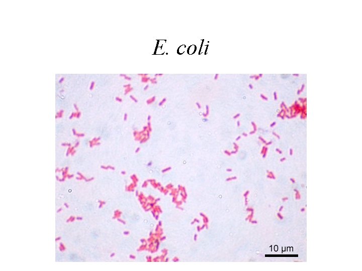 E. coli 