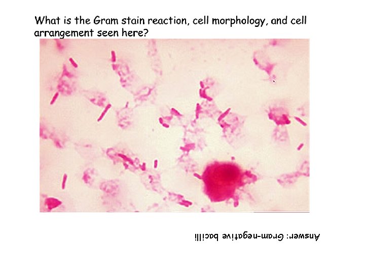 Answer: Gram-negative bacilli 