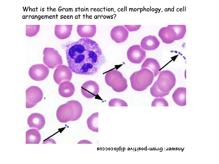 Answer: Gram-positive diplococcus 
