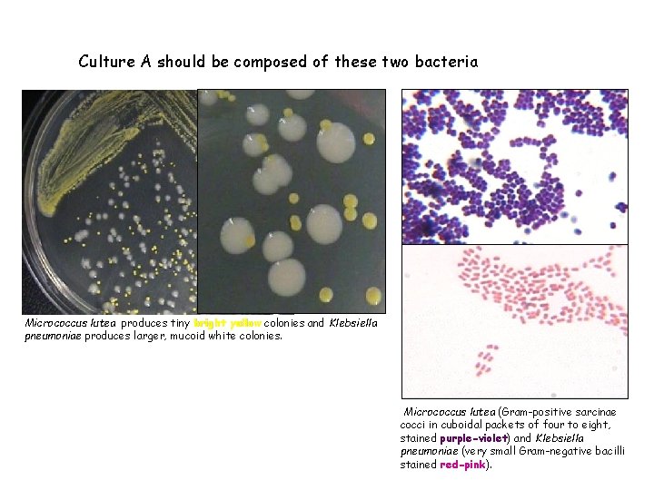 Culture A should be composed of these two bacteria Micrococcus lutea produces tiny bright