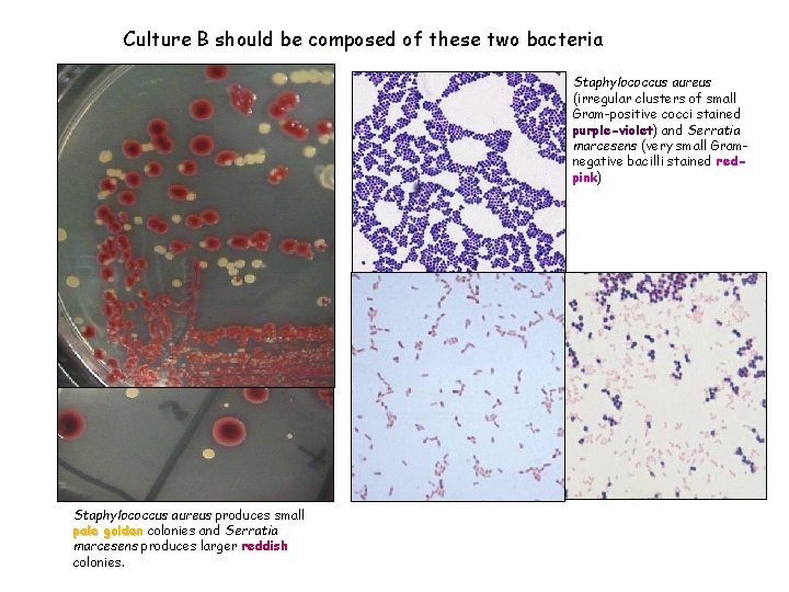 Culture B should be composed of these two bacteria Staphylococcus aureus (irregular clusters of