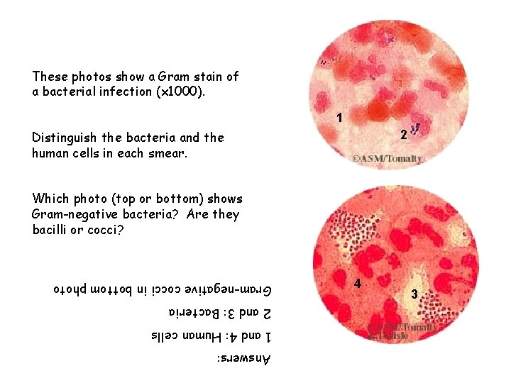 These photos show a Gram stain of a bacterial infection (x 1000). 1 2