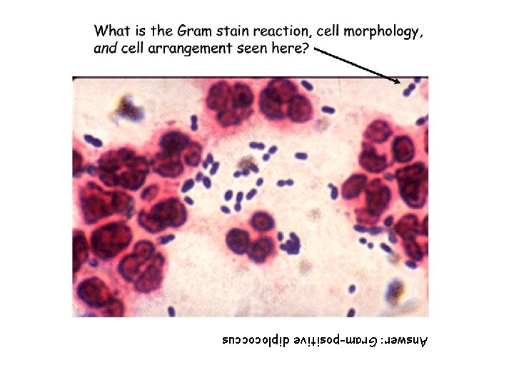 Answer: Gram-positive diplococcus 