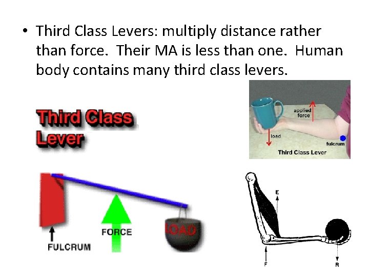  • Third Class Levers: multiply distance rather than force. Their MA is less
