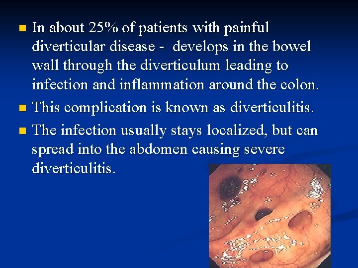 In about 25% of patients with painful diverticular disease - develops in the bowel