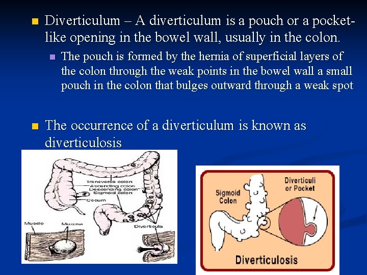 n Diverticulum – A diverticulum is a pouch or a pocketlike opening in the