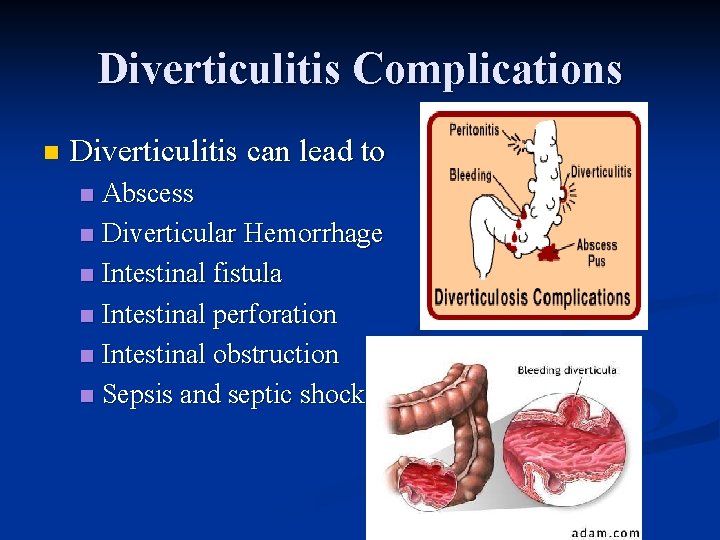 Diverticulitis Complications n Diverticulitis can lead to Abscess n Diverticular Hemorrhage n Intestinal fistula