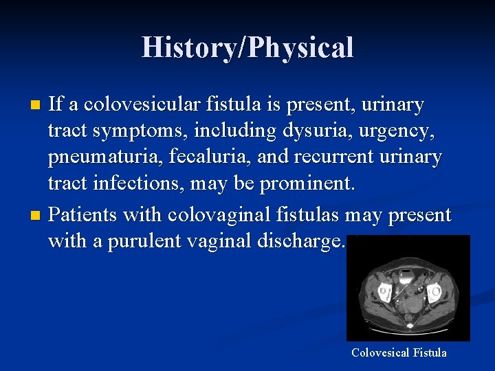 History/Physical If a colovesicular fistula is present, urinary tract symptoms, including dysuria, urgency, pneumaturia,