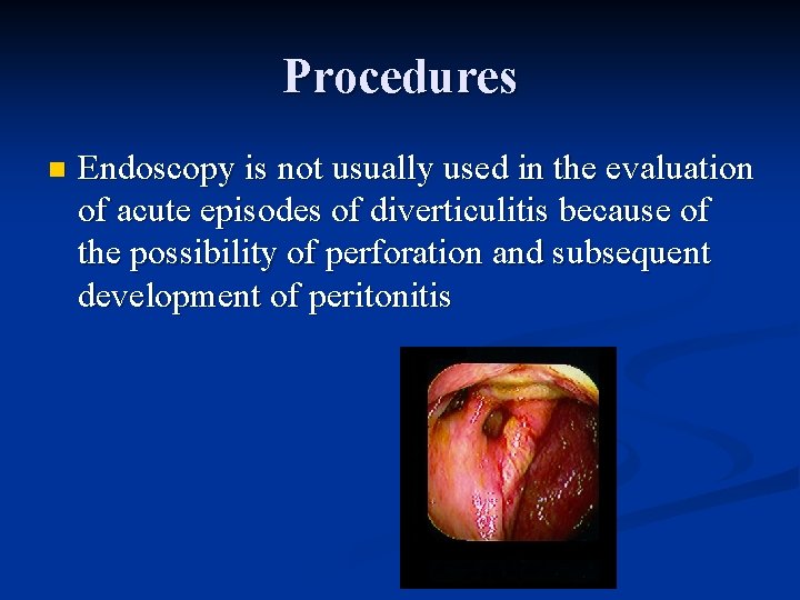 Procedures n Endoscopy is not usually used in the evaluation of acute episodes of