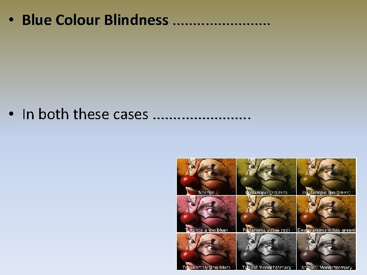  • Blue Colour Blindness. . . • In both these cases. . .