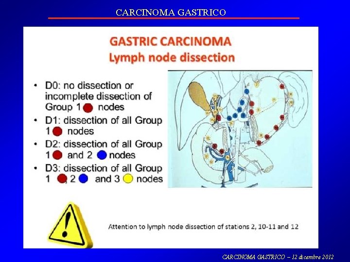 CARCINOMA GASTRICO – 12 dicembre 2012 