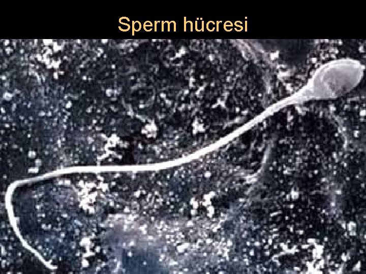 Sperm hücresi 