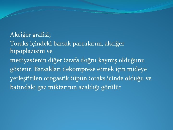 Akciğer grafisi; Toraks içindeki barsak parçalarını, akciğer hipoplazisini ve mediyastenin diğer tarafa doğru kaymış Akciğer grafisi; Toraks içindeki barsak parçalarını, akciğer hipoplazisini ve mediyastenin diğer tarafa doğru kaymış