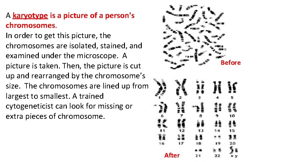 A karyotype is a picture of a person's chromosomes. In order to get this