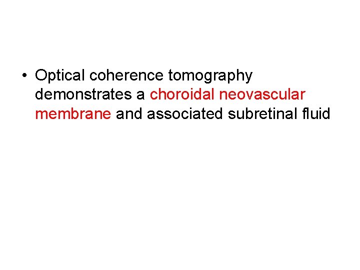  • Optical coherence tomography demonstrates a choroidal neovascular membrane and associated subretinal fluid