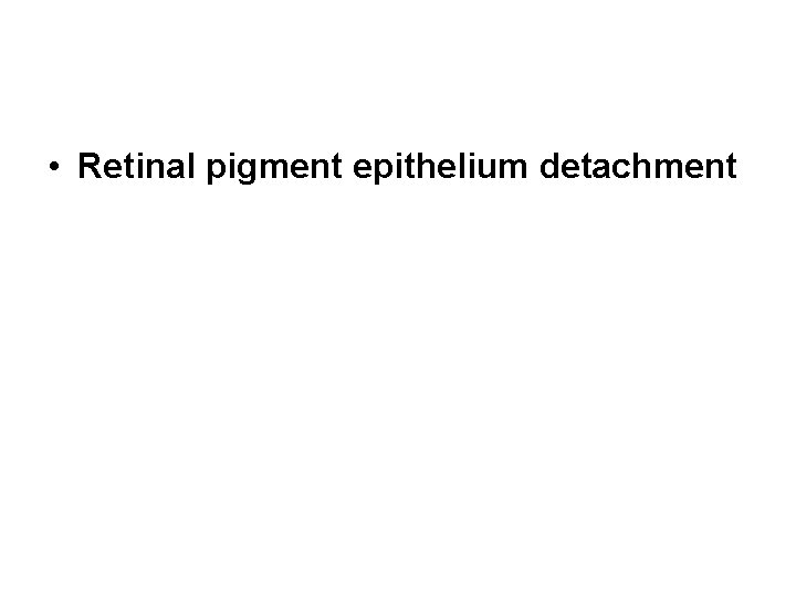  • Retinal pigment epithelium detachment 