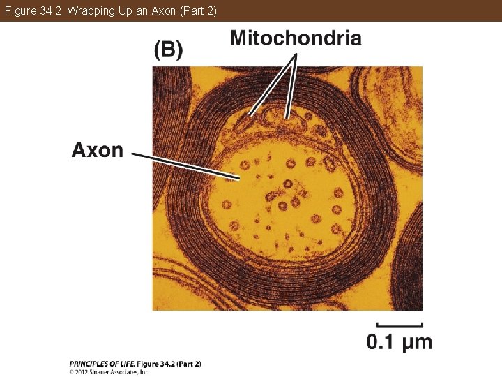 Figure 34. 2 Wrapping Up an Axon (Part 2) 