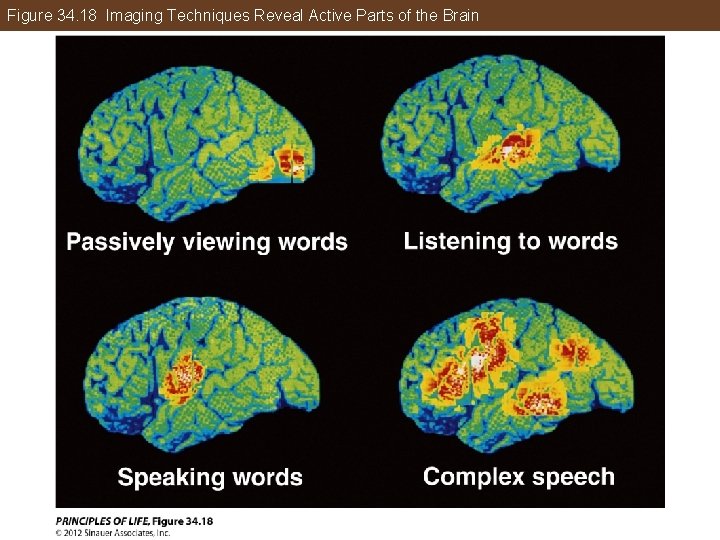 Figure 34. 18 Imaging Techniques Reveal Active Parts of the Brain 