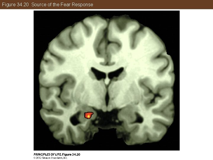 Figure 34. 20 Source of the Fear Response 
