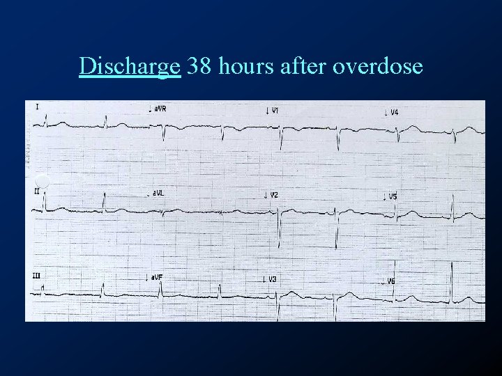 Discharge 38 hours after overdose 