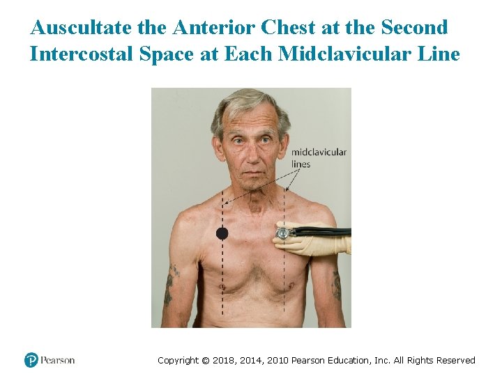 Auscultate the Anterior Chest at the Second Intercostal Space at Each Midclavicular Line Copyright