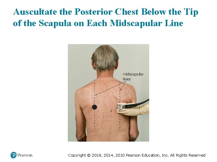 Auscultate the Posterior Chest Below the Tip of the Scapula on Each Midscapular Line
