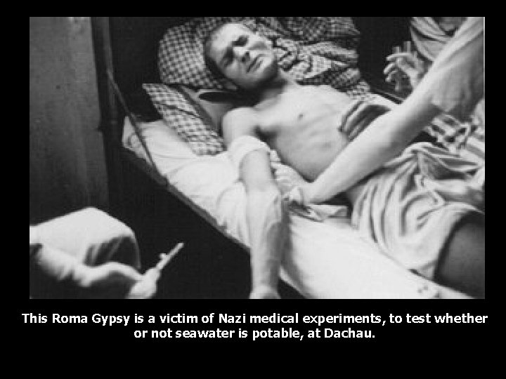 This Roma Gypsy is a victim of Nazi medical experiments, to test whether or