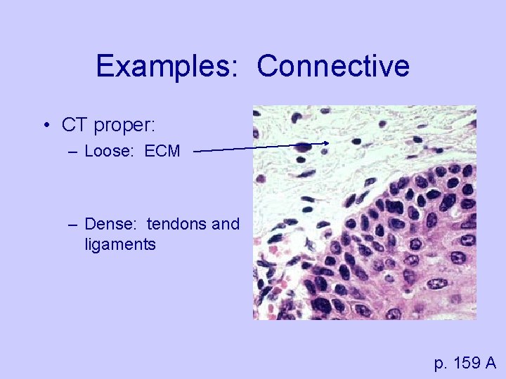 Examples: Connective • CT proper: – Loose: ECM – Dense: tendons and ligaments p.