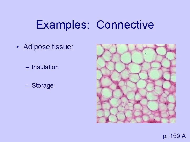 Examples: Connective • Adipose tissue: – Insulation – Storage p. 159 A 