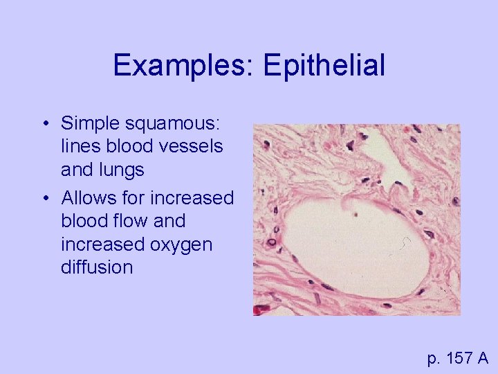 Examples: Epithelial • Simple squamous: lines blood vessels and lungs • Allows for increased