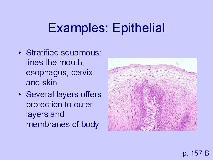 Examples: Epithelial • Stratified squamous: lines the mouth, esophagus, cervix and skin • Several