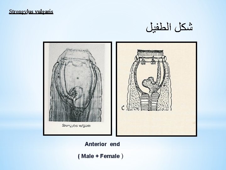 Strongylus vulgaris ﺷﻜﻞ ﺍﻟﻄﻔﻴﻞ Anterior end ( Male + Female ) 