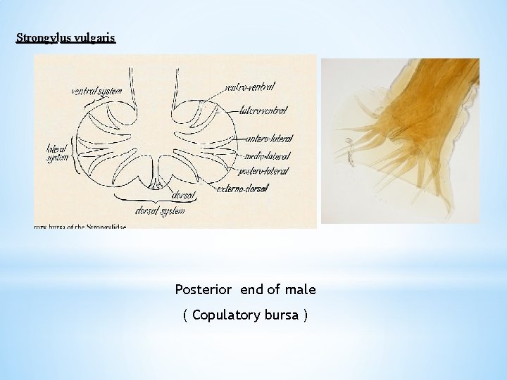 Strongylus vulgaris Posterior end of male ( Copulatory bursa ) 