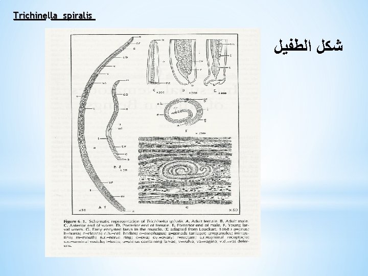 Trichinella spiralis ﺷﻜﻞ ﺍﻟﻄﻔﻴﻞ 