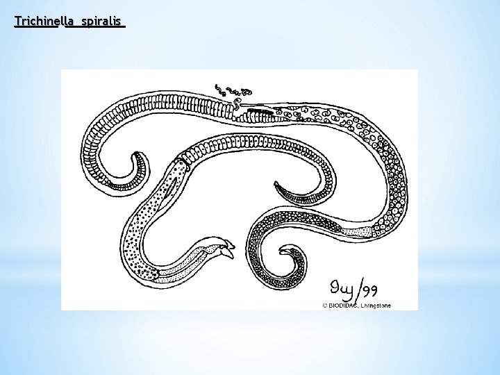 Trichinella spiralis 