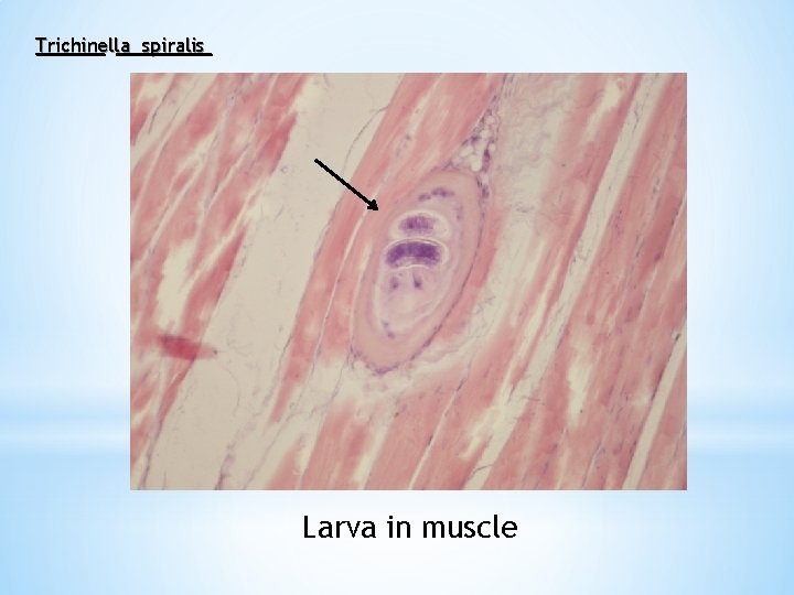 Trichinella spiralis Larva in muscle 