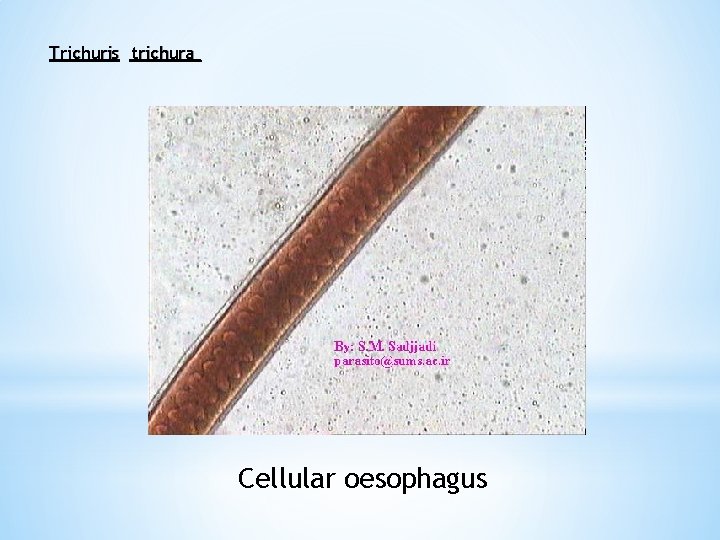 Trichuris trichura Cellular oesophagus 