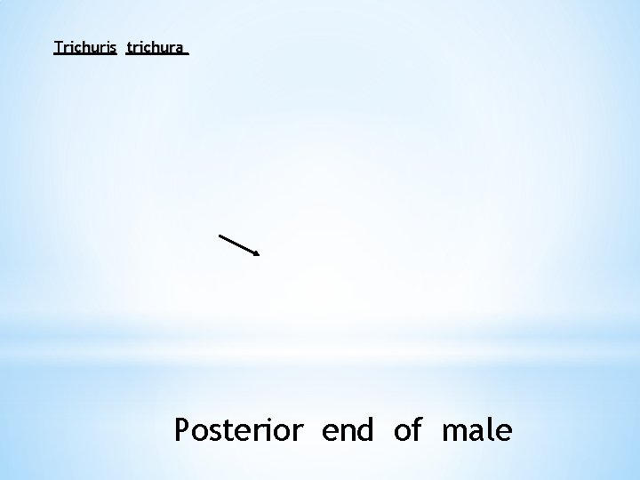 Trichuris trichura Posterior end of male 