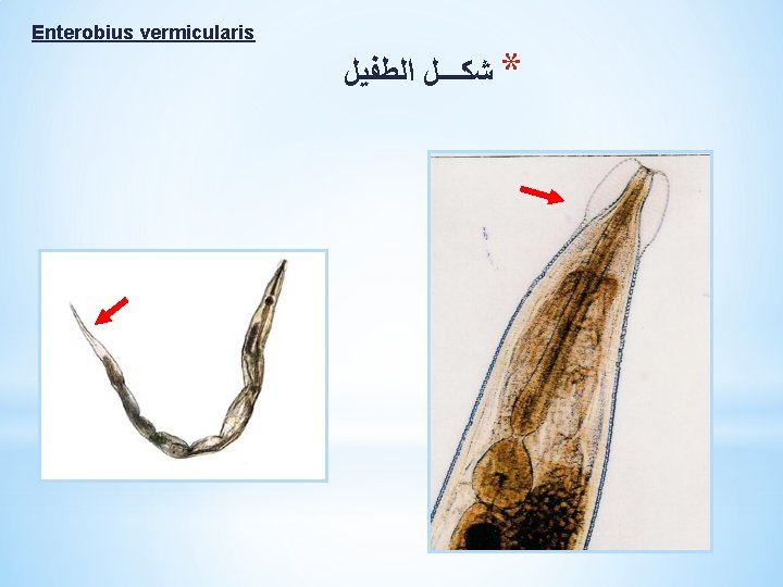 Enterobius vermicularis * ﺷﻜـــﻞ ﺍﻟﻄﻔﻴﻞ 
