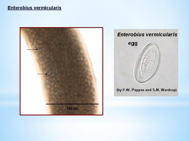 Enterobius vermicularis 