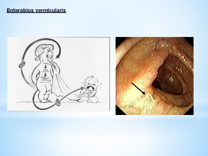 Enterobius vermicularis 