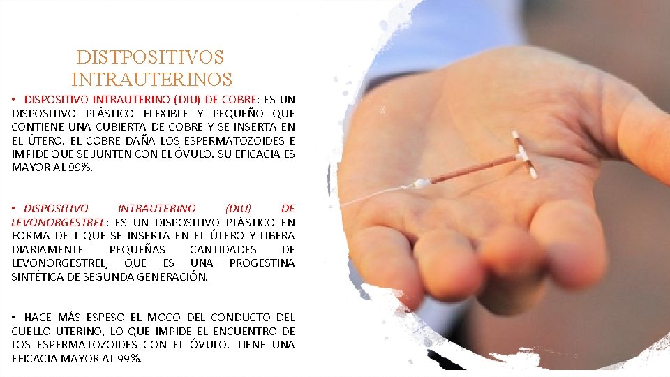 DISTPOSITIVOS INTRAUTERINOS • DISPOSITIVO INTRAUTERINO (DIU) DE COBRE: ES UN DISPOSITIVO PLÁSTICO FLEXIBLE Y