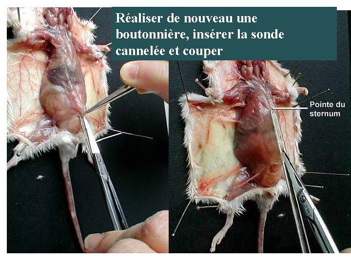 Réaliser de nouveau une boutonnière, insérer la sonde cannelée et couper 