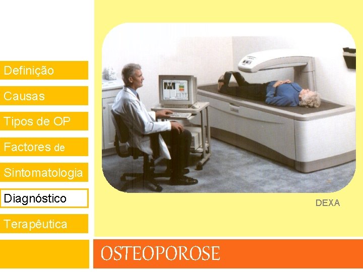 Definição Causas Tipos de OP Factores de risco Sintomatologia Diagnóstico DEXA Terapêutica OSTEOPOROSE 