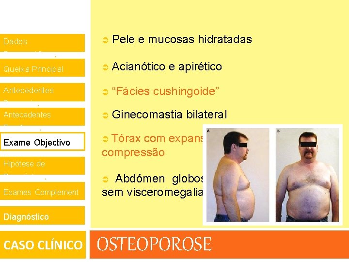  Pele e mucosas hidratadas Queixa Principal. Acianótico e apirético Antecedentes “Fácies cushingoide” Ginecomastia