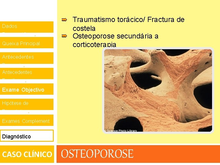 Dados Demográficos. Queixa Principal. Traumatismo torácico/ Fractura de costela Osteoporose secundária a corticoterapia Antecedentes