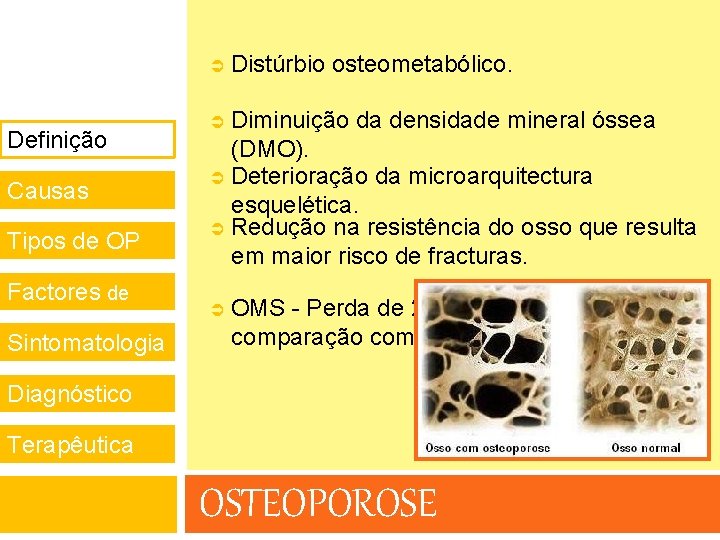  Definição Causas Tipos de OP Factores de risco Sintomatologia Distúrbio osteometabólico. Diminuição da