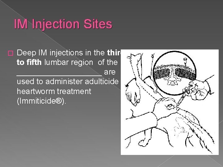 IM Injection Sites � Deep IM injections in the third to fifth lumbar region