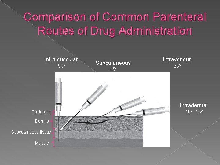 Comparison of Common Parenteral Routes of Drug Administration Intramuscular 90° Subcutaneous 45° Intravenous 25°